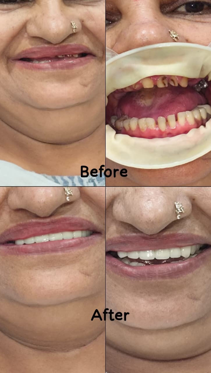 Before and After Dental Transformations at Smile Dental Care